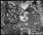 Bhopal Child Victim