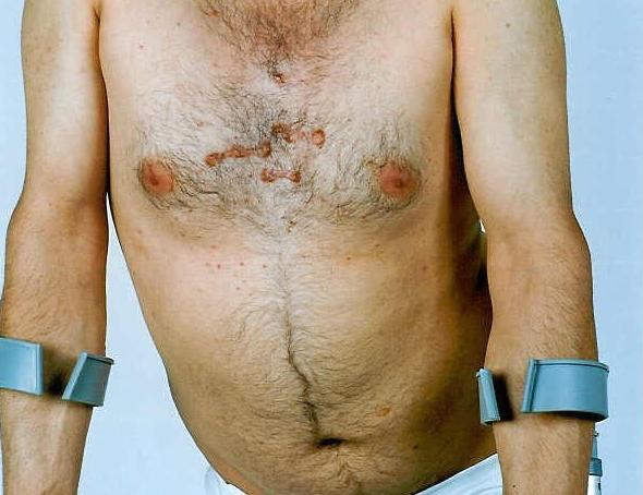 UK denies asylum to survivor of torture