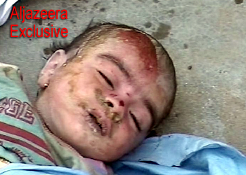 Fallujah child victim of American terrorism