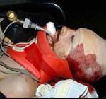 Israeli Soldiers Shoot At Parents of Injured British Pacifist