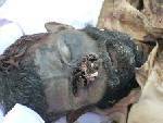 A Bugti tribesman who was burnt alive by Pakistan's Military Intelligence.