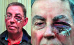 Far right attack pensioner in Lewisham