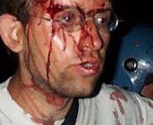 Photos of victim with facial injuries