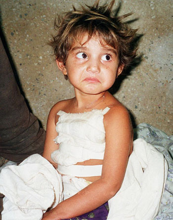 'High qualified Military' from the US-UK against Children, Elders and Hospitals