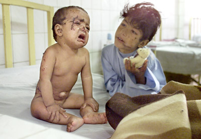 'High qualified Military' from the US-UK against Children, Elders and Hospitals