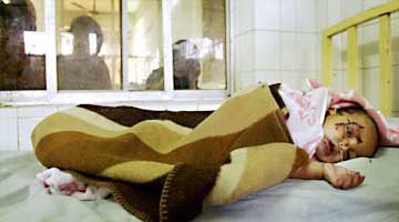 Terrible Images of a "Just" War