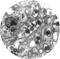 Exclusive Indymedia preview