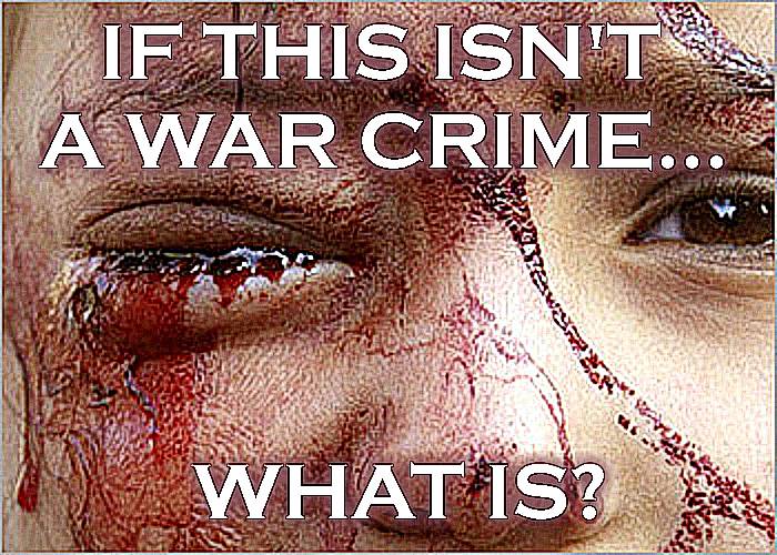 IF THIS ISN'T A WAR CRIME...