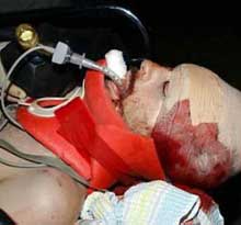 Israeli Soldiers Shoot At Parents of Injured British Pacifist