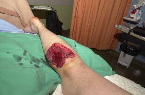 Injured IMCuk Photographer Was Targeted