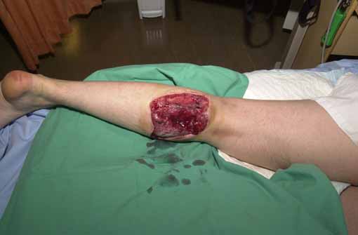 Injured IMCuk Photographer Was Targeted