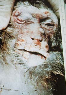 The blood's on Prescott and Blairs hands!! The slimy SCUM!