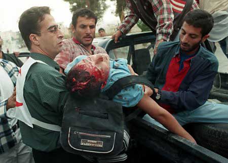 Palestinian kid, coming from school, had his head blown up by IDF soldiers.