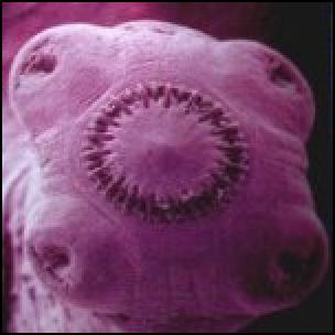 Duck and Cover! Here comes the US/Isreali tape worm