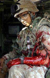 Wounded US Soldier