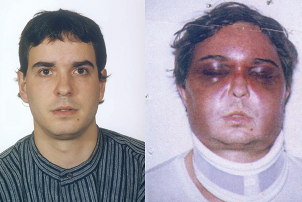 Unai Romano, before and after be tortured for the spanish police