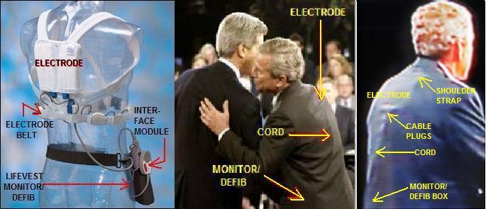 LifeVest Defibrillator/Mr. Kerry/Mr. Bush