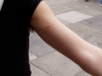 result of police brutality