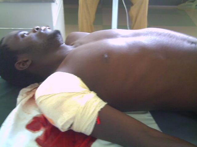 he was shot in the back abd bull tore through the front of his hand