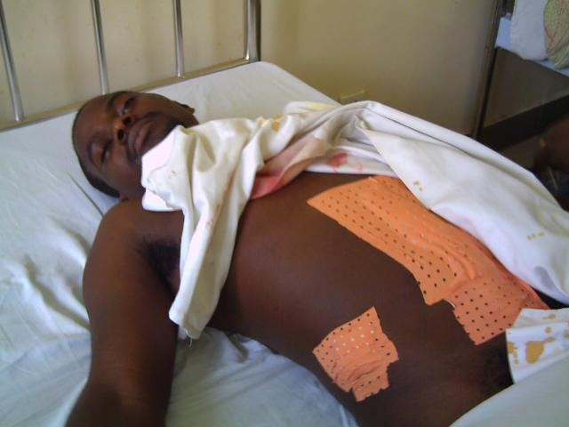 this person was shot through the stomach