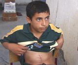 Mustapha, 12, lives in the railway station. On April28, 2005 shot by an American