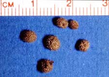 Seemingly great attainment?