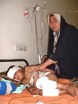 Iraq bomb victim