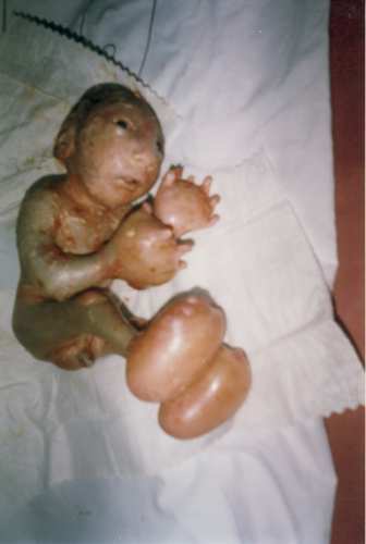 DEPLEATED URANIUM BABY