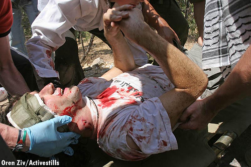 street medics take care of the wounded activist