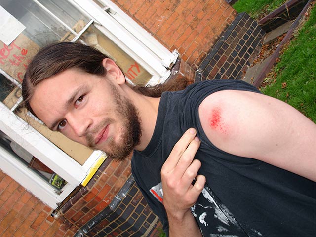 some injuries sustained...