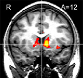 Shoppers brain scan: