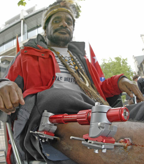 Benny show me his wounds