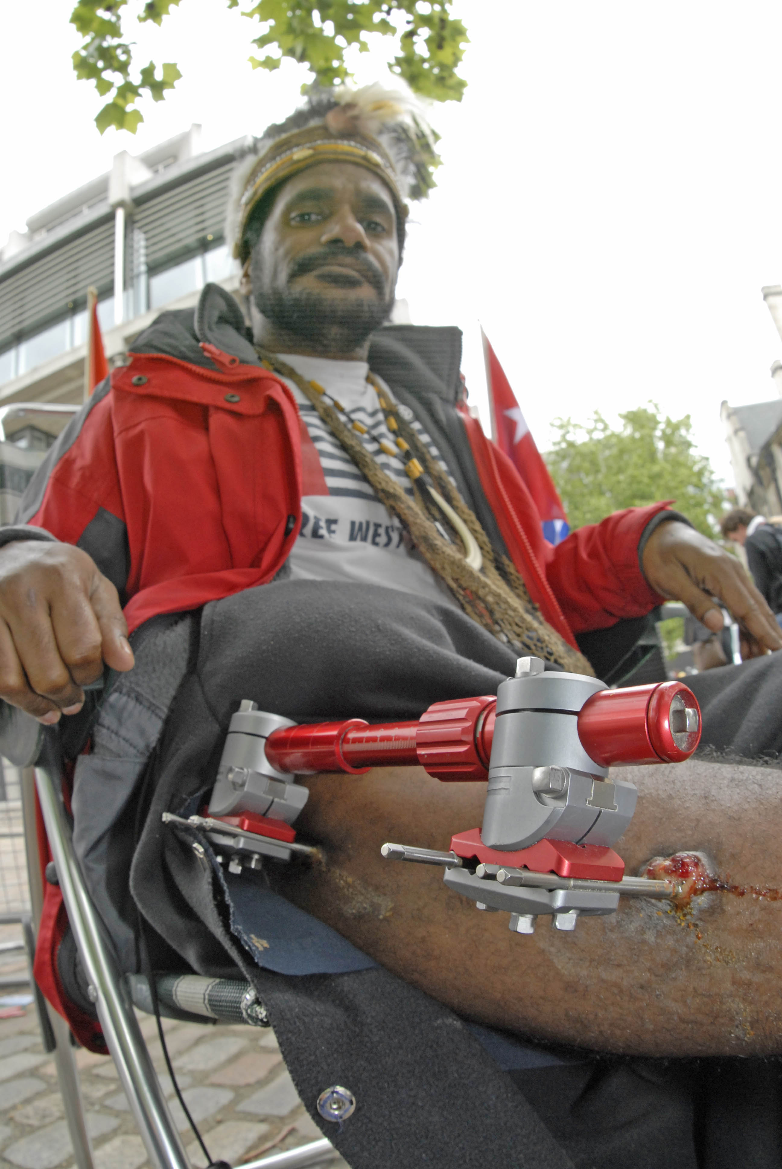 Benny shows me his wounds