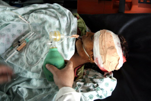 Sara Ghazal, 10, critically wounded died later in hospital