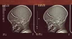 The Hacker Would Like You To Forget This