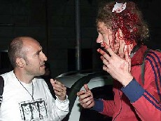 One of many injured in the raid