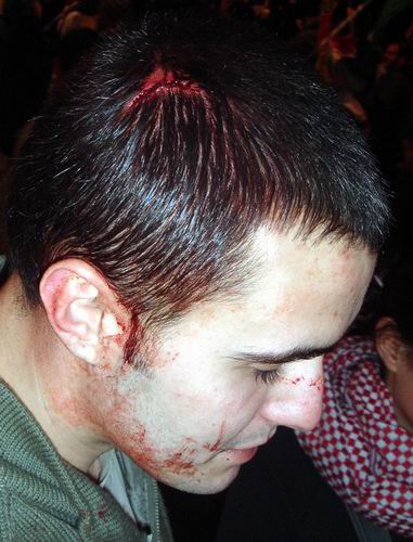 baton whacked near Piccadilly underpass