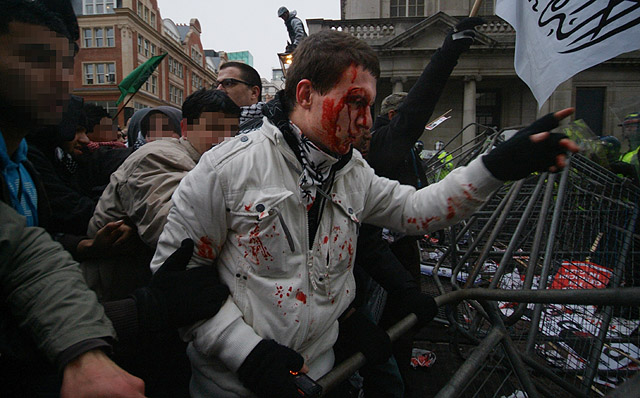 A man with head injury.