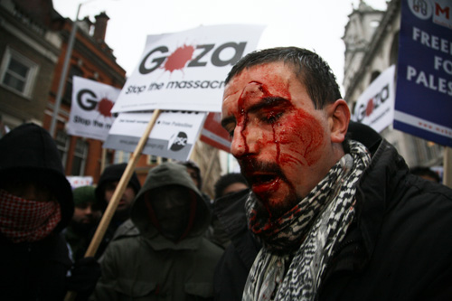 A bloody protester injured expressing his anger at IsraeI's onslaught in Gaza