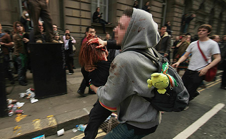 A young woman receives a head injury.