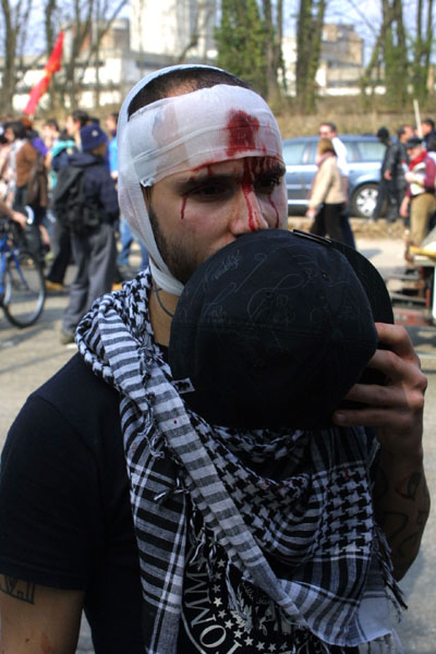 Bloody but Unbowed ! an injured protester bleeding