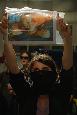 A horribly wounded victim of the arms-trade.