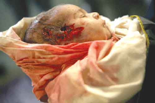 Israeli bullet hole,look at this picture if you can