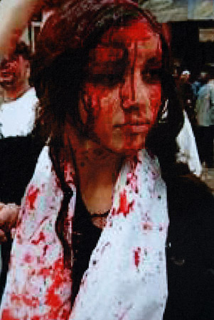 A bloodied Iranian woman.