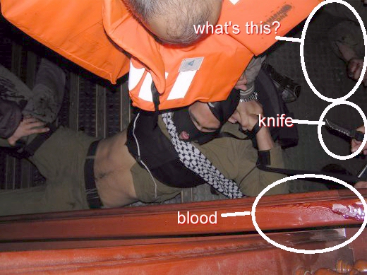 A wounded man blood & a knife. Where did they come from?OMG ZIONIST CONSPIRACY