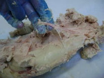 The delicacy of despair