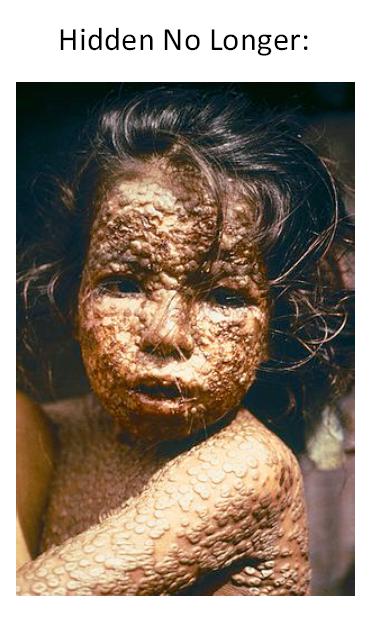 Caption Hidden no longer: Genocide in the Americas by the pious Christians