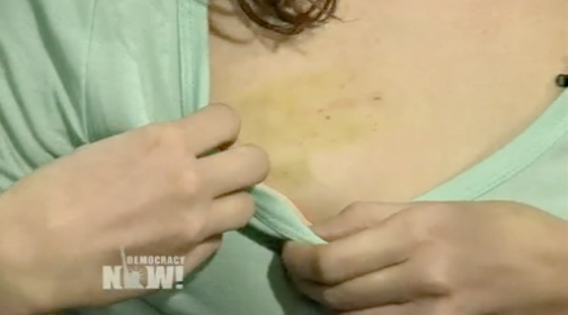 screenshot of Cecily McMillan on Democracy now