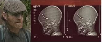 David Myatt – Child Killer With One of His Victims