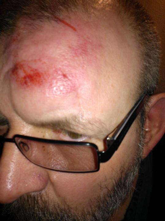 Head injury to Essex sab